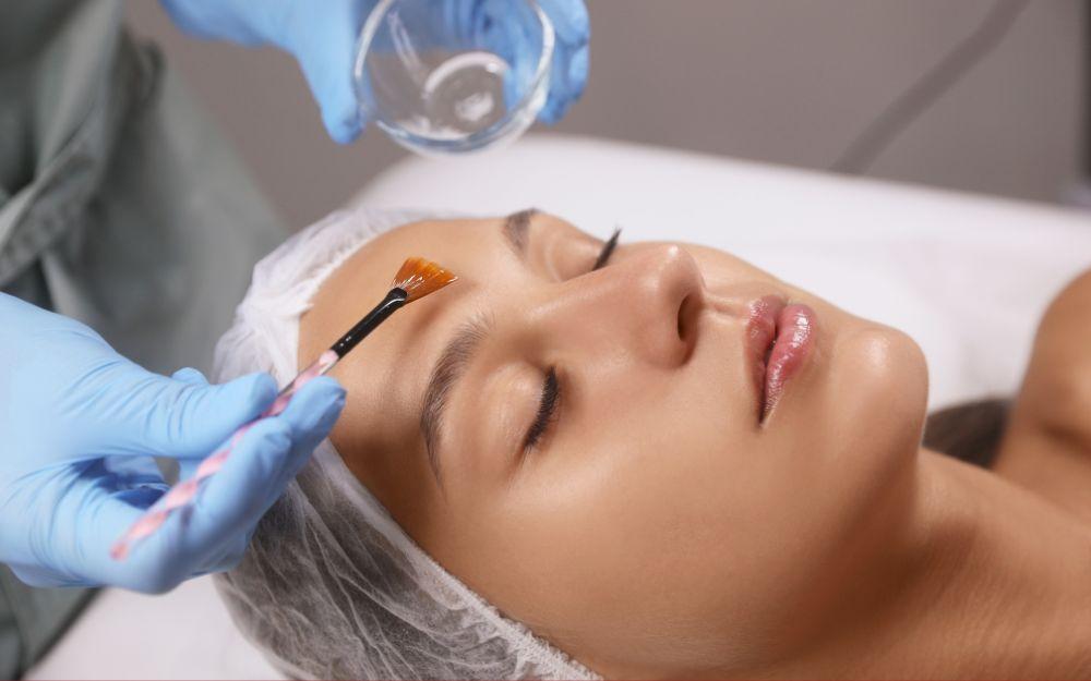Có nên peel da mặt không? Ưu điểm và hạn chế của peel da mặt